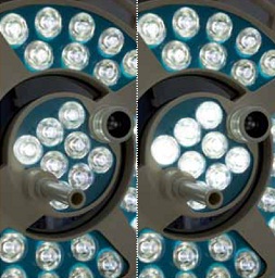 外科手術用LED照明灯　Mach LED 2